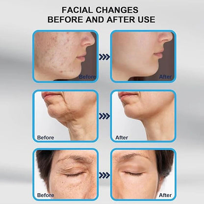 Derma Stamp Micro Needling Tool