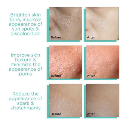 Derma Stamp Micro Needling Tool